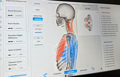 Advanced 3D Posture Scan