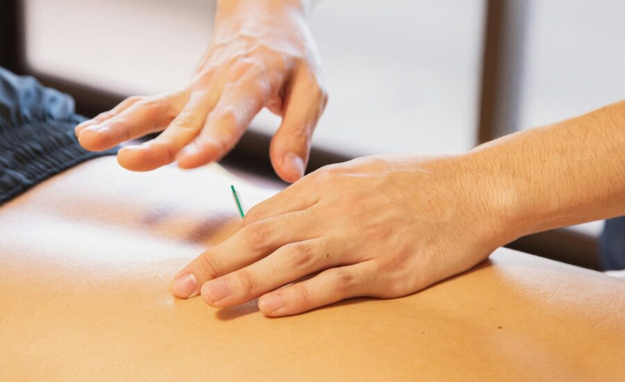 Acupuncture Dry Needling