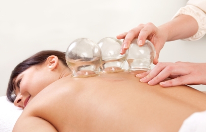 Cupping Therapy