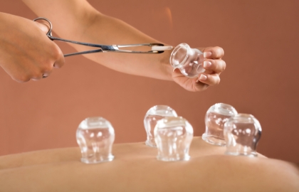 Cupping Therapy