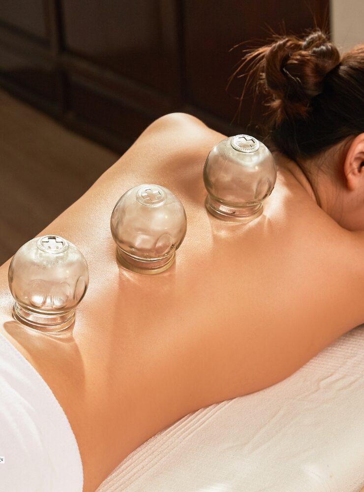 Cupping Therapy