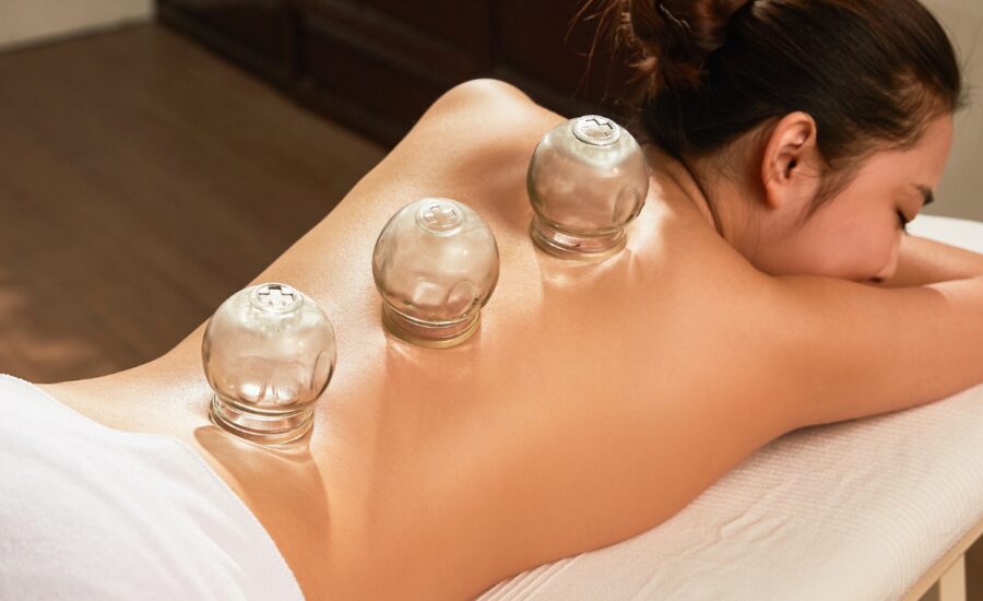 Cupping Therapy