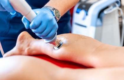 Focused Shockwave Therapy