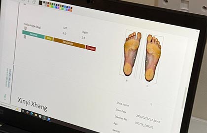 Orthotics Assessment